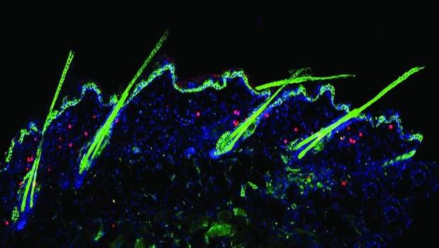 Hallan una nueva vía prometedora para prevenir y revertir la calvicie