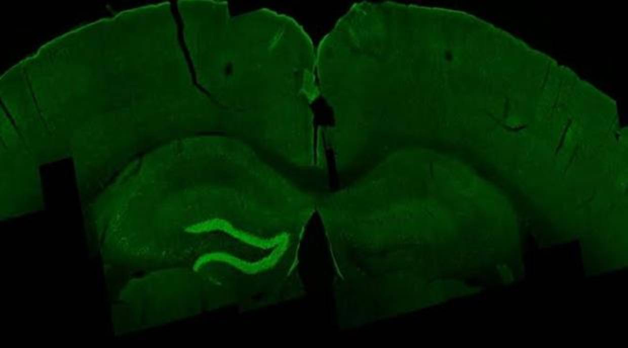 Estimulación con la ETI del hipocampo (en verde) de un ratón