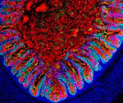Desarrollado el primer ‘mini-colon’ humano a partir de células madre