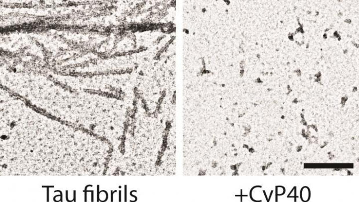 Desagregación de ovillos neurofibrilares de proteína tau tras la exposición a Cyp40 (derecha)