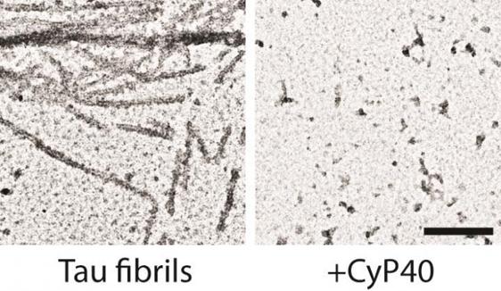 Desagregación de ovillos neurofibrilares de proteína tau tras la exposición a Cyp40 (derecha)