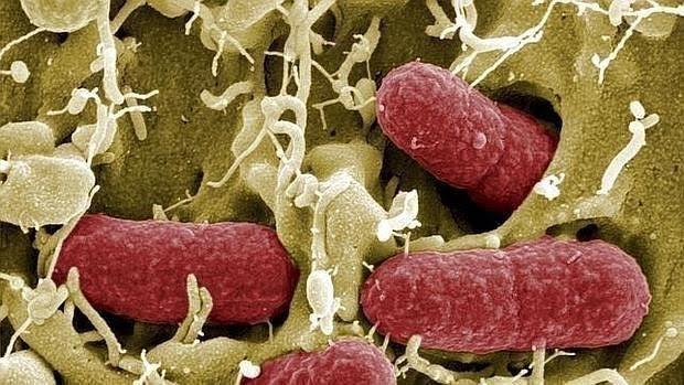 Los probióticos pueden ser muy útiles para prevenir y tratar el cáncer colorrectal