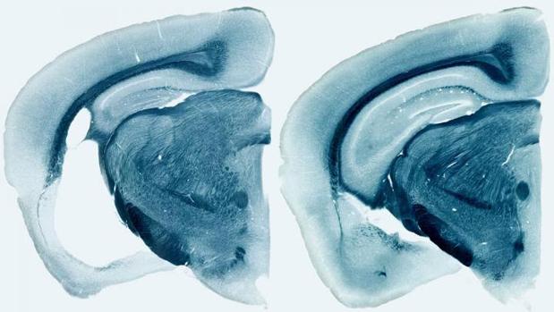 Reducir los niveles de proteína ApoE es la clave para prevenir o detener el alzhéimer