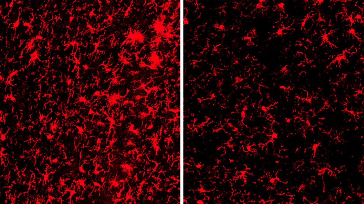 Las células inmunes están más activadas (rojo) en los cerebros de los ratones con el gen TREM2 (izquierda) que en aquellos sin el gen (derecha).