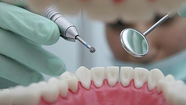 Las bacterias causantes de la periodontitis también aumentan el riesgo de cáncer de esófago