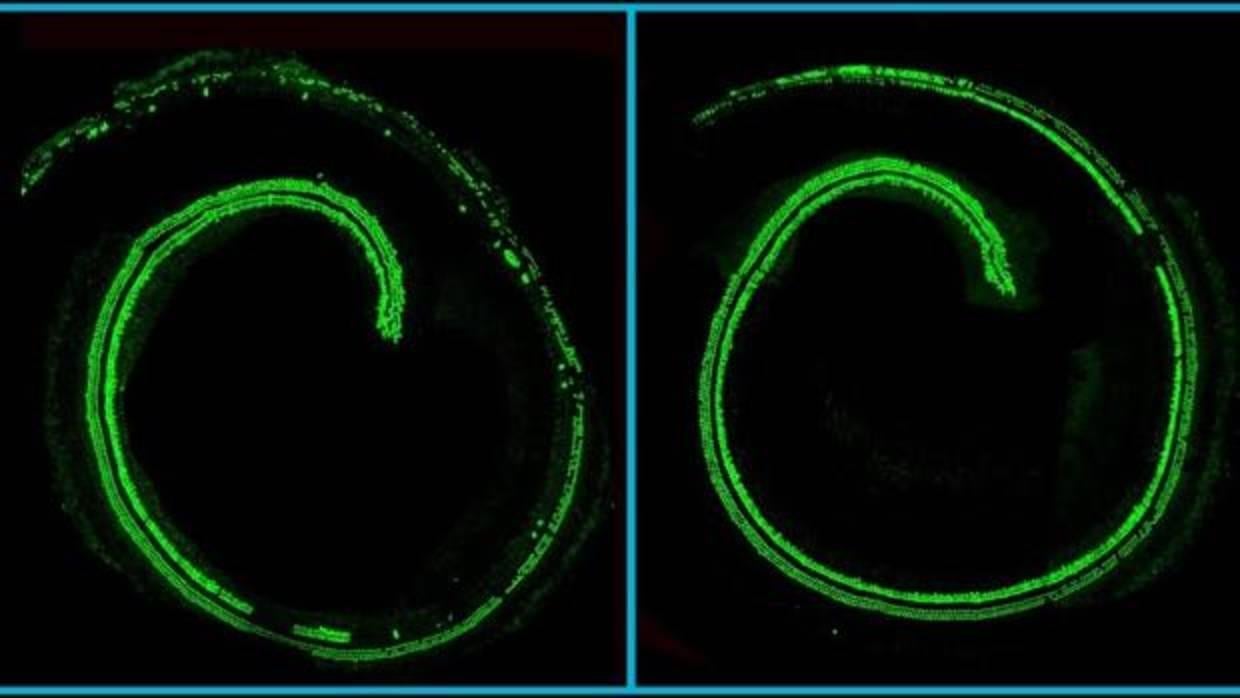 El tratamiento evita la pérdida de células pilosas en la cóclea (izquierda)