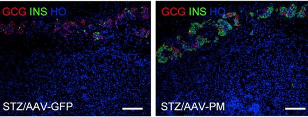 Diseñada una terapia génica capaz de normalizar los niveles de glucosa en la diabetes