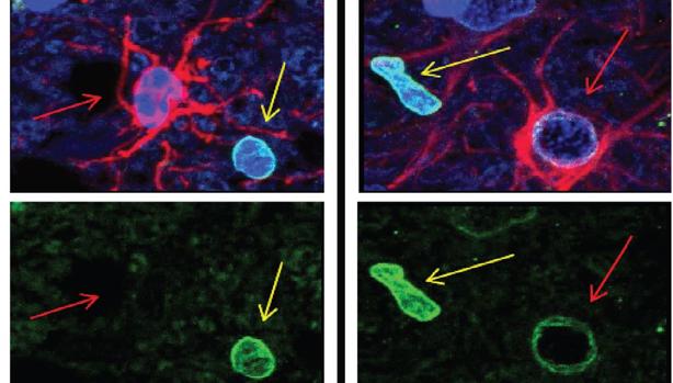 Un tipo de neuronas, posible diana para un tratamiento futuro del párkinson