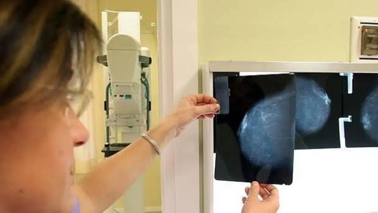 Radiografía de una paciente con cáncer de mama