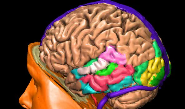 Sufrir una única conmoción cerebral leve es suficiente para aumentar el riesgo de párkinson