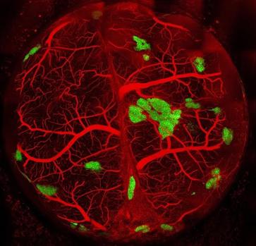 Fabrican islotes pancreáticos capaces de curar la diabetes tipo 1 en ratones