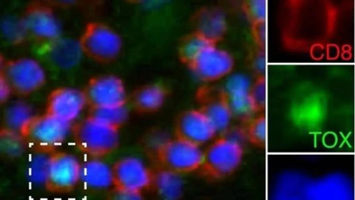 Expresión de TOX (en verde) en linfocitos T CD8+ (en rojo) en la esclerosis múltiple
