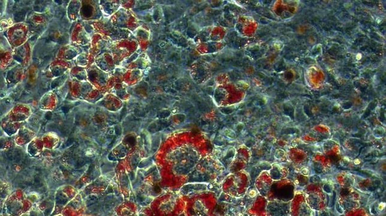 Imagen por microscopía del tejido adiposo marrón