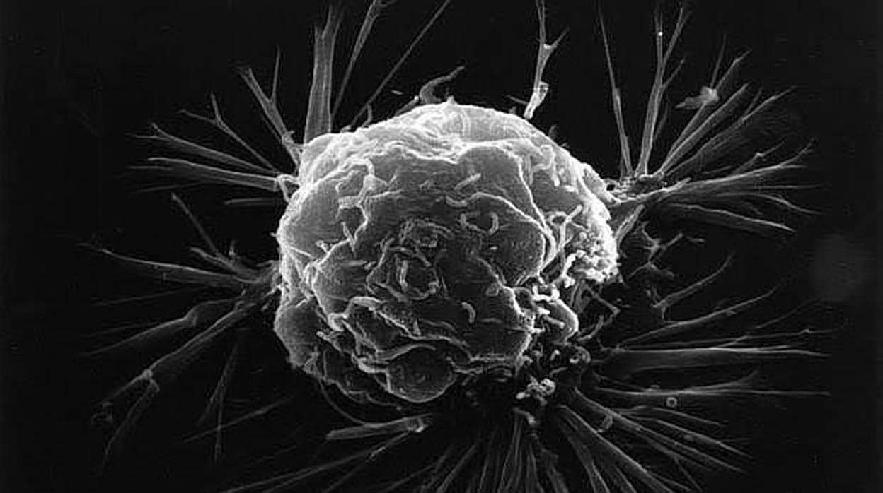 Célula cáncer de mama