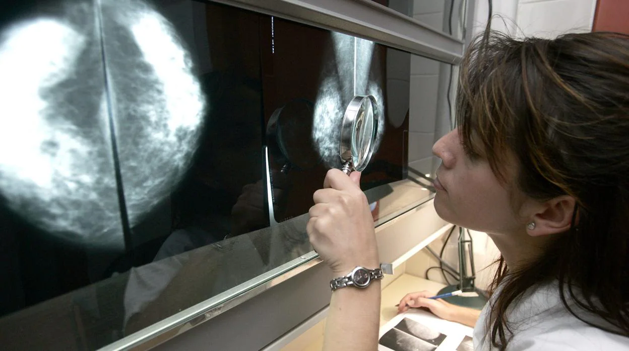 El cribado de cáncer de mama no reduce la mortalidad, los nuevos tratamientos sí