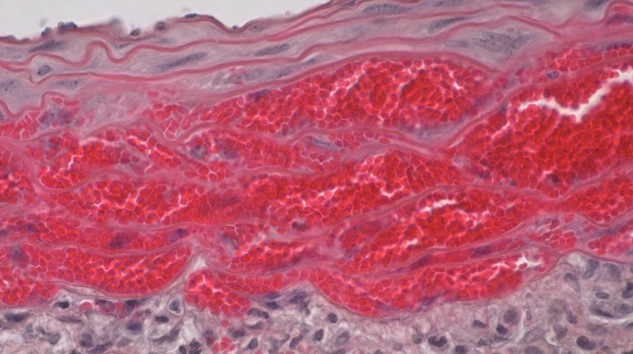 Imagen microscópica de hematoma intramural en el modelo preclínico de la enfermedad. Se muestra la acumulación de la sangre invadiendo la capa media de la aorta.