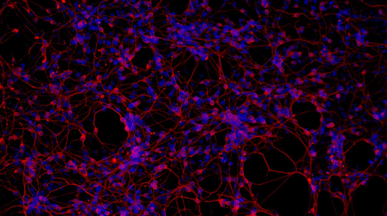 Una nueva vía para la prevención del alzhéimer: aceite de oliva