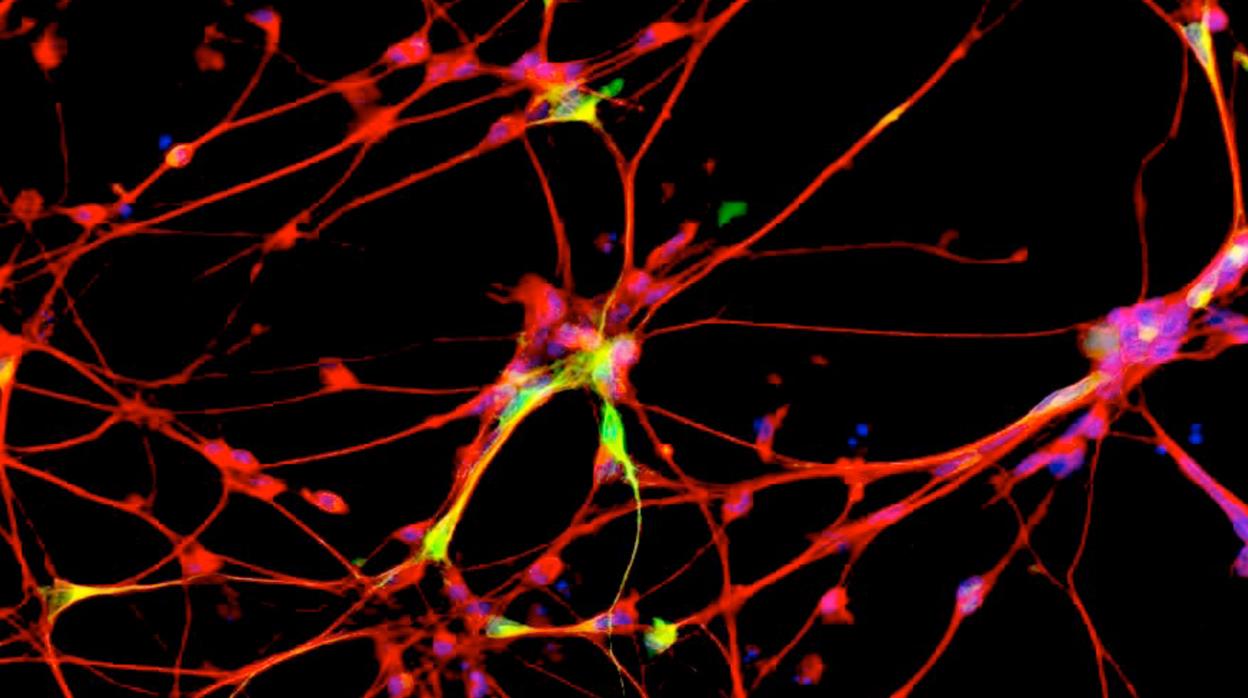 Regeneración axonal