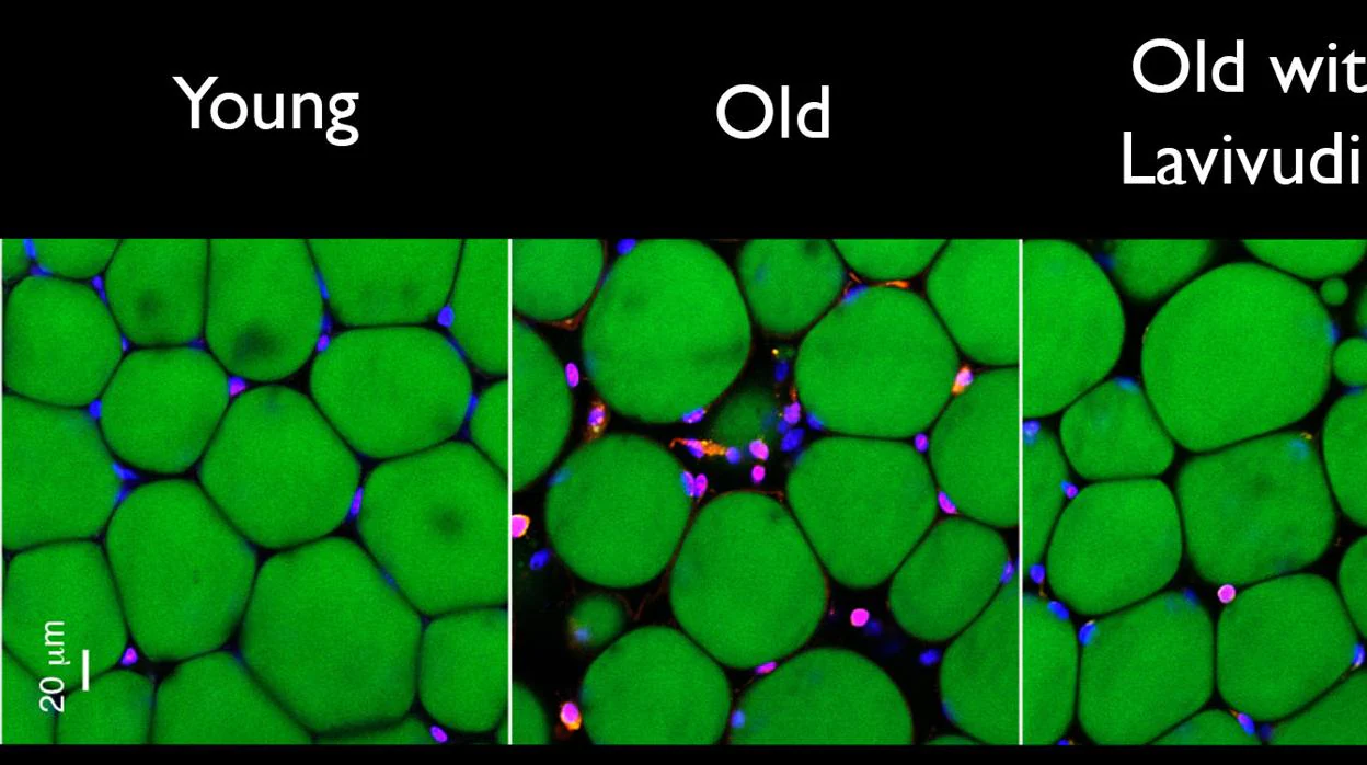 Dos semanas de tratamiento redujeron los signos de inflamación crónica (los glóbulos blancos teñidos de rosa entre las células grasas verdes) en el tejido adiposo del ratón.
