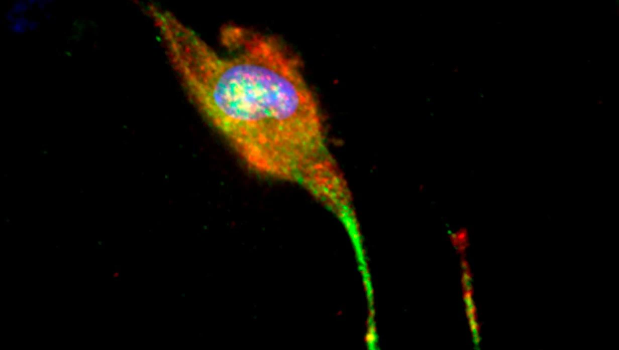 Neurona generada de células de la piel de paciente