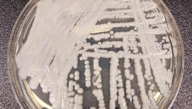 Candida auris, el peligroso hongo resistente a los medicamentos que se extiende por el mundo