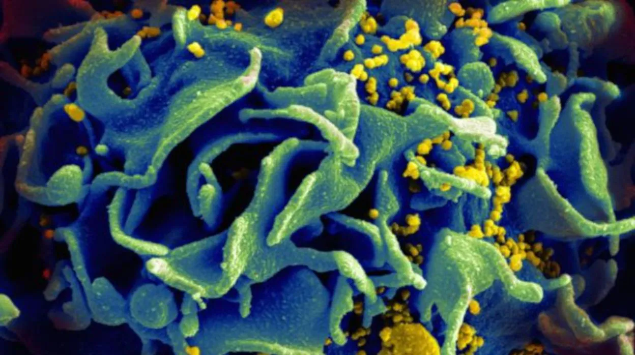 Imagen microscópica de una célula T infectada por el VIH.