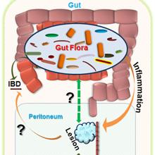 Endometriosis