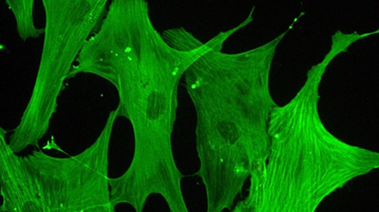 Células de válvulas aórticas humanas con sus microfilamentos tintados vistas al microscopio