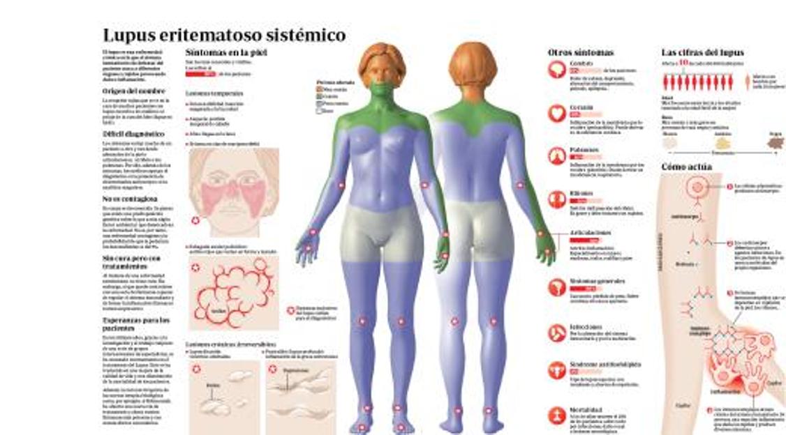 Eritema: Síntomas, causas y cómo tratar la enfermedad