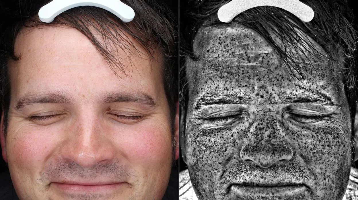Los retratos ultravioleta permiten ver los daños invisibles del sol en la piel