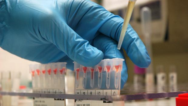 Un análisis de sangre detecta el cáncer de pulmón 4 años antes que las técnicas actuales