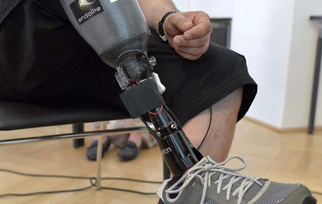 Consiguen que dos personas con las piernas amputadas puedan &#039;sentir&#039; sus prótesis