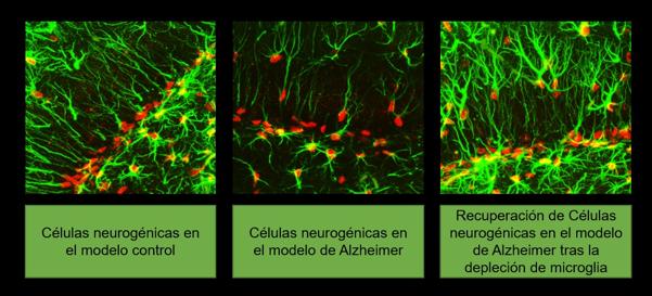 La española que investiga una nueva diana para tratar el alzhéimer