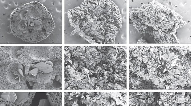 Lo último para el VIH: un implante inyectable de larga duración