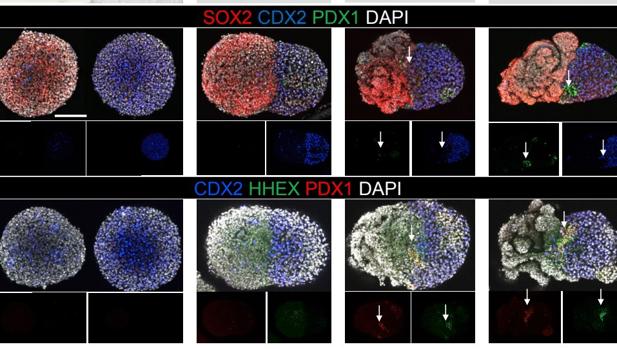 Fabrican el primer sistema funcional de tres organoides humanos: hígado, páncreas y tracto biliar