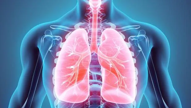 Las cuatro claves para evitar el cáncer de pulmón, la Epoc y otras enfermedades respiratorias