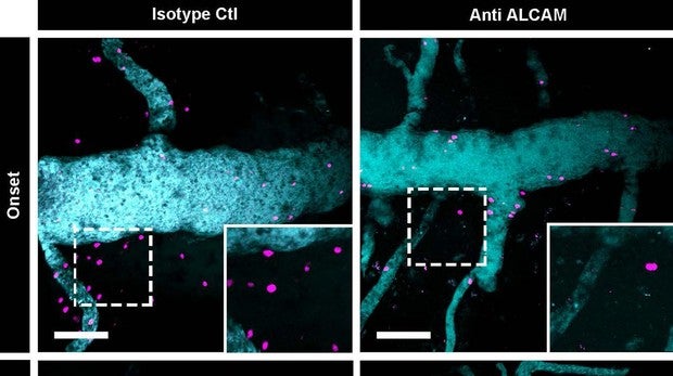 La molécula que puede llevar al desarrollo de una nueva  terapia para la esclerosis múltiple