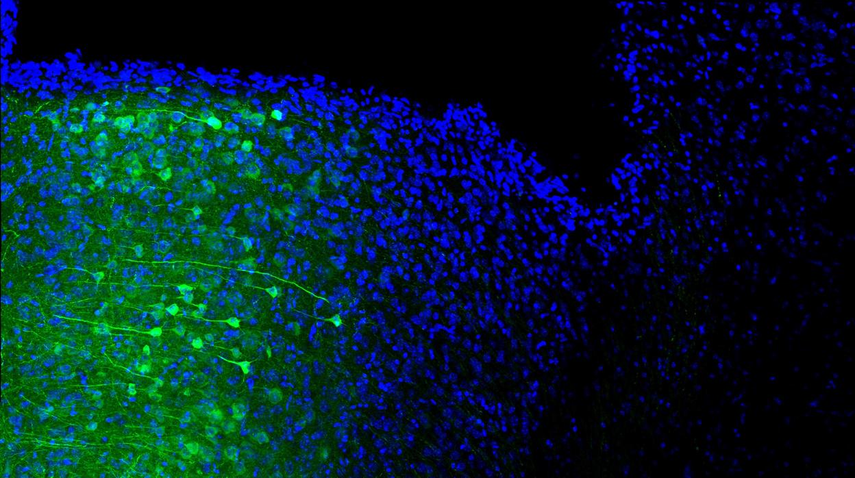 Núcleos (azul) de las neuronas de la corteza prefrontal medial que proyectan sus axones (verde) al área gris periacueductal.