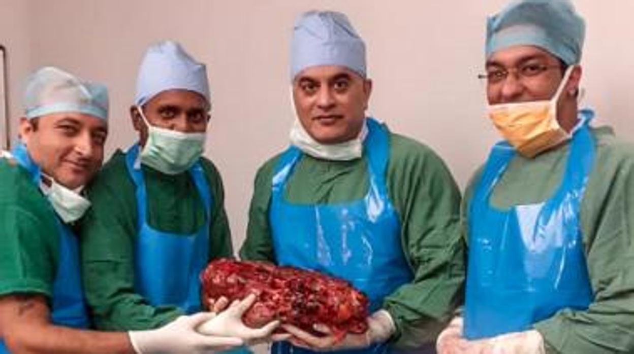 El equipo médico que extirpó el riñón de más de 7 kilos en India