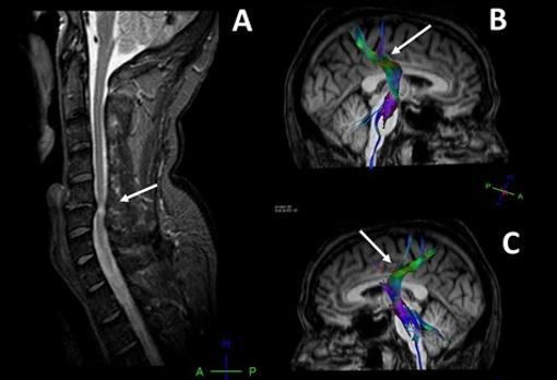 Técnicas de neuroimagen