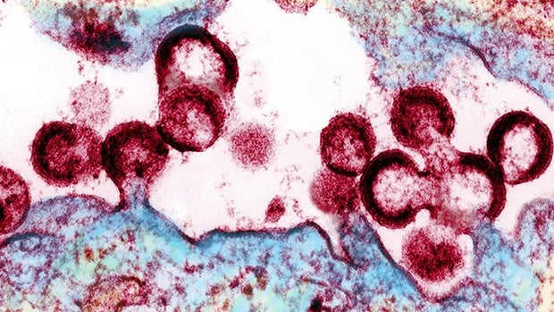 Tratar el VIH lo más pronto posible destruye a límites indetectables la cantidad de virus