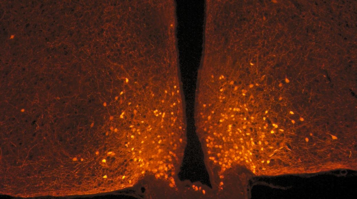 Neuronas POMC (puntos naranjas) en el hipotálamo de un ratón, ubicadas en la base del cerebro. Foto tomada de un ratón con un microscopio confocal.