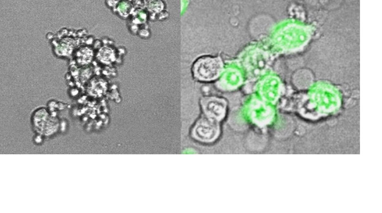 Células cancerosa frías, a la izda., y 'calientes' a la dcha.