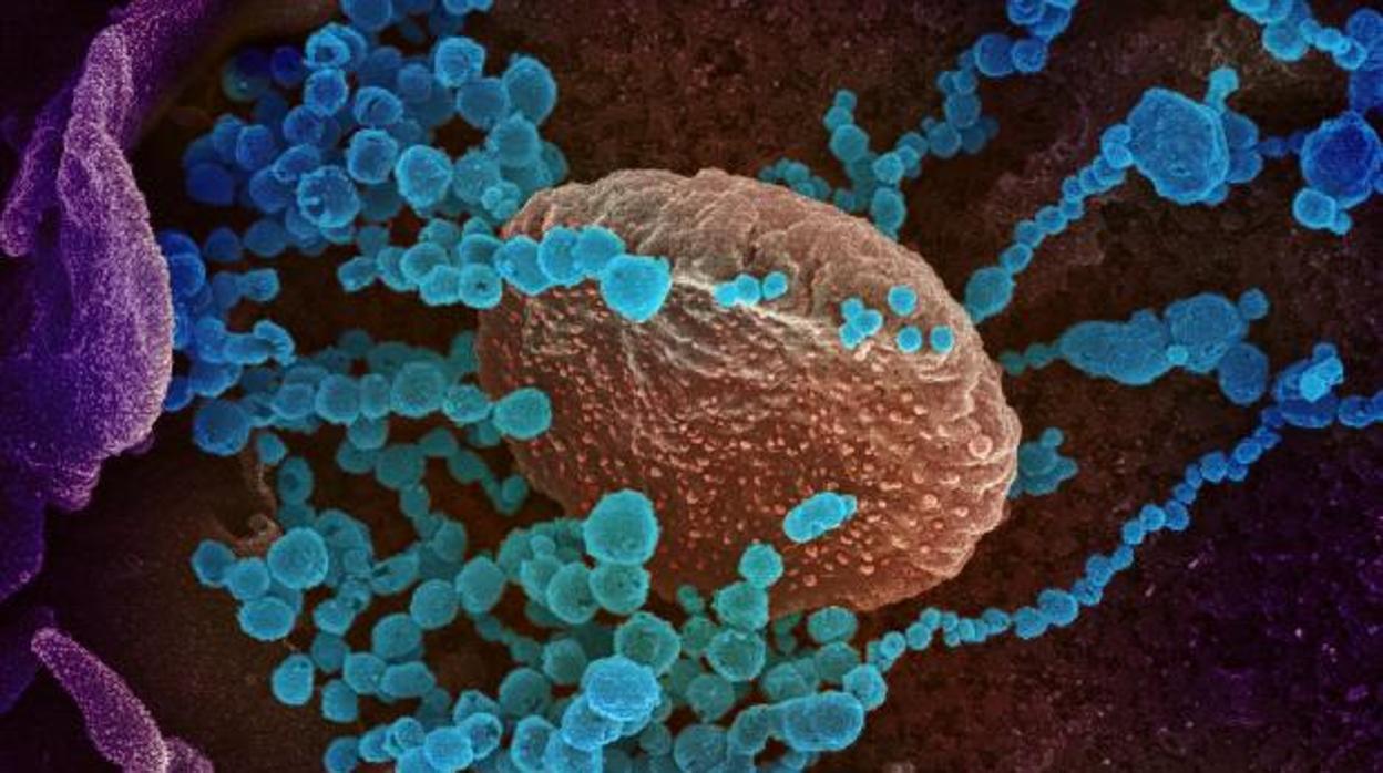 Coronavirus: PharmaMar anuncia que su tratamiento contra el coronavirus ...