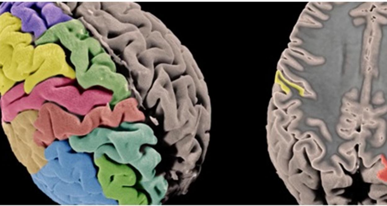 Superficie y grosor de la corteza cerebral.