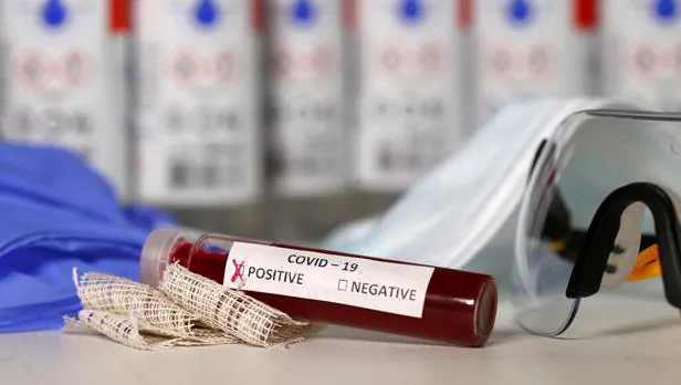 El uso antipalúdicos para evitar Covid-19 puede dejar desabastecidos a pacientes que los necesitan