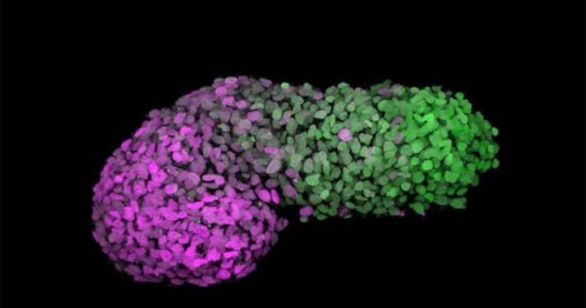 Gastruloide humano 72h después de la agregación. El verde marca la parte posterior, similar al extremo de la cola de un embrión (CDX2); y el magenta marca la parte anterior, similar a las células del corazón en desarrollo (GATA6).