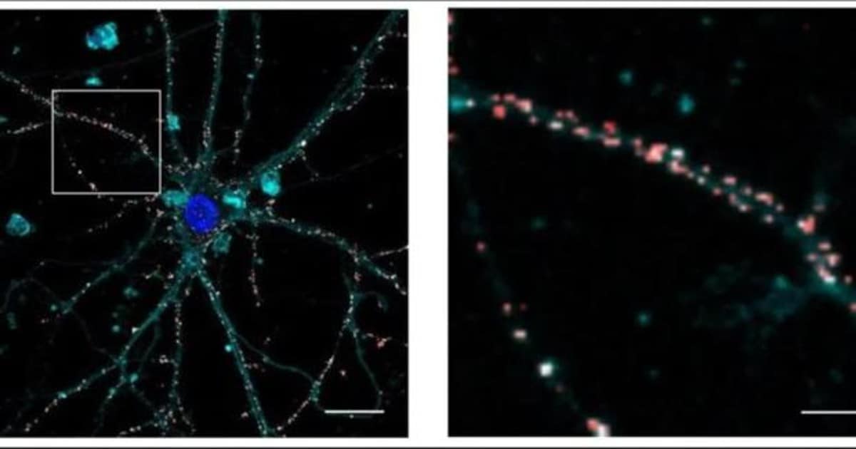 Imagen de microscopía confocal fluorescencia que muestra nanopartículas (en rojo) depositadas en las membranas neuronales (en azul marino) sin ingresar a las células