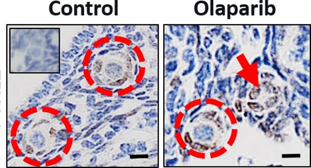 La imagen muestra dos folículos primordiales sanos que contienen óvulos en este ovario de ratón normal (control, izquierda). Pero después de olaparib, abundan los restos primarios de folículos que carecen de óvulos, lo que sugiere que este nuevo medicamento contra el cáncer de mama mata los óvulos.