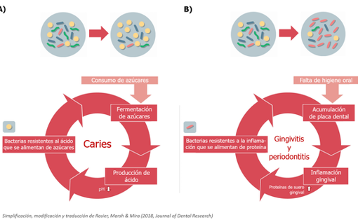 Por ejemplo, si consumimos azúcar, las bacterias de la placa dental que se alimentan de azúcares aumentan en número. Éstas convierten el azúcar en ácidos orgánicos